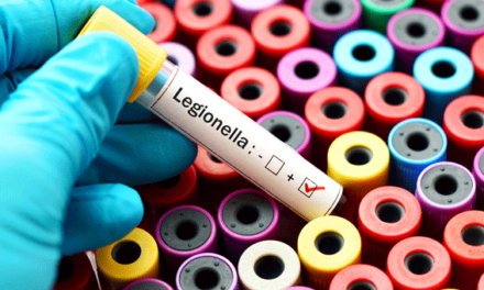 Legionella tem nova portaria, mas plataforma de registo continua em falta